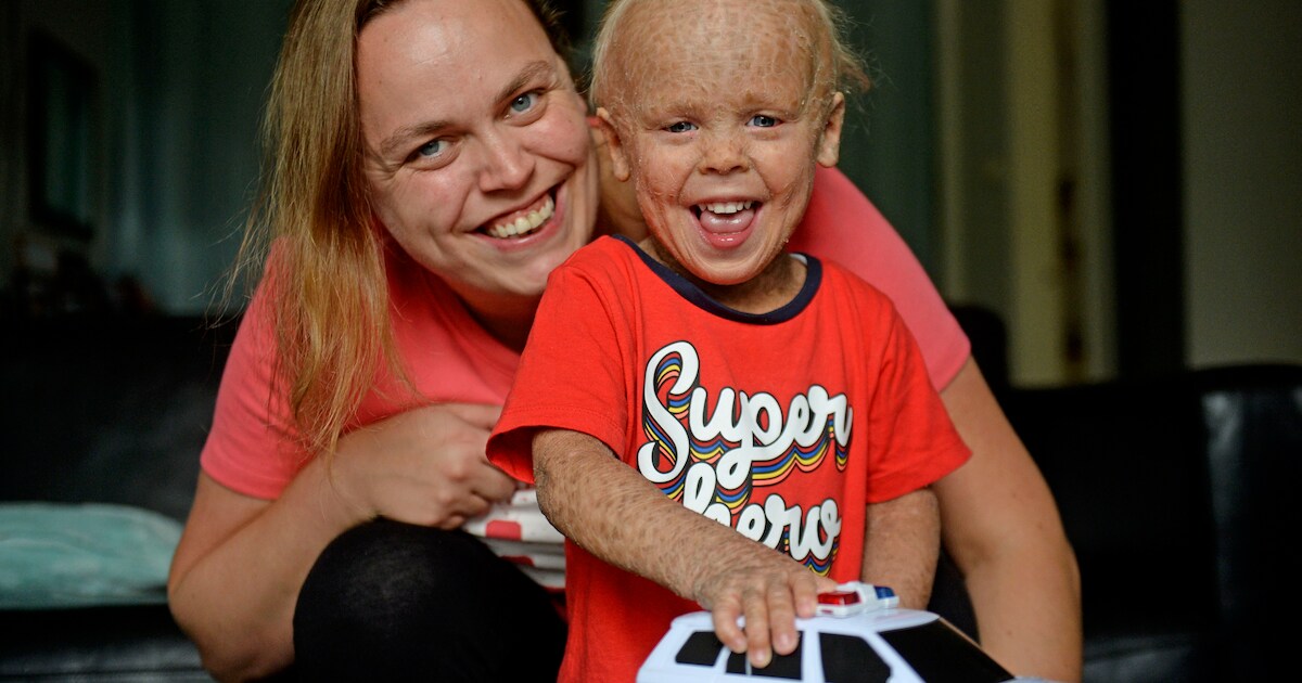 Huid van Westerhaarse Hugo (2) soepeler door zuurstofbad