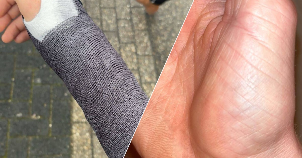 Beveiliger bij Bruins duwt man (22) uit Hengelo omver, die breekt botje in zijn hand