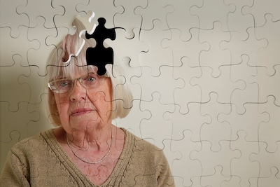 Nieuw medicijn tegen alzheimer zou weinig effect hebben: ‘En bijwerkingen kunnen aanzienlijk zijn’