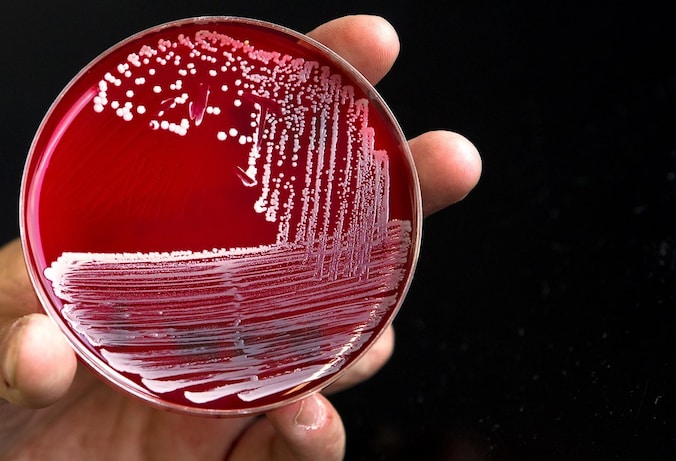 Opnamestop Twents ziekenhuis om MRSA-bacterie | Nieuws | Tubantia.nl